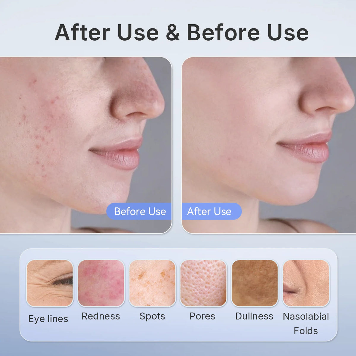 Hello Face Wireless Near-Infrared and Red Light Facial Mask For Powerful Professional Ultra-light Mask