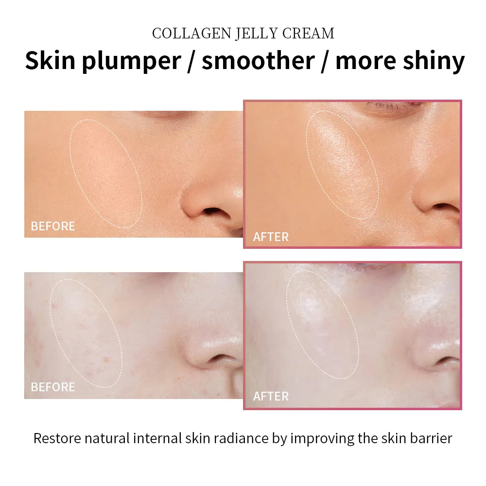 100ml Collagen Jelly Cream Niacinamide Tightening Soothing Moisturizing Anti-Aging Firmness Hydration Skincare 100ml Face Gel