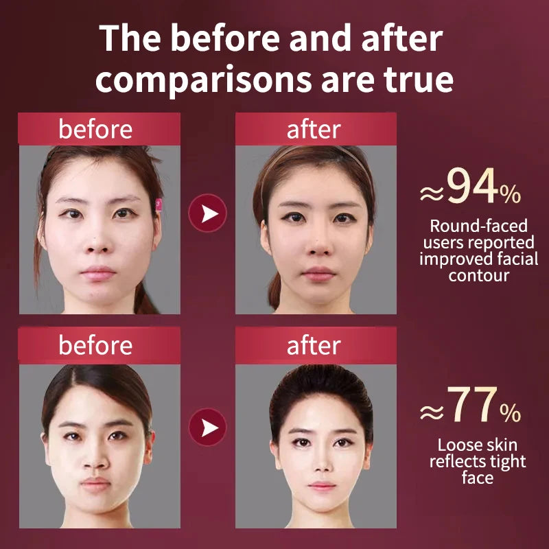 V-Face Massager for Facial Lifting, Tightening, and Sagging Prevention with 12 Adjustable Modes for Home Use