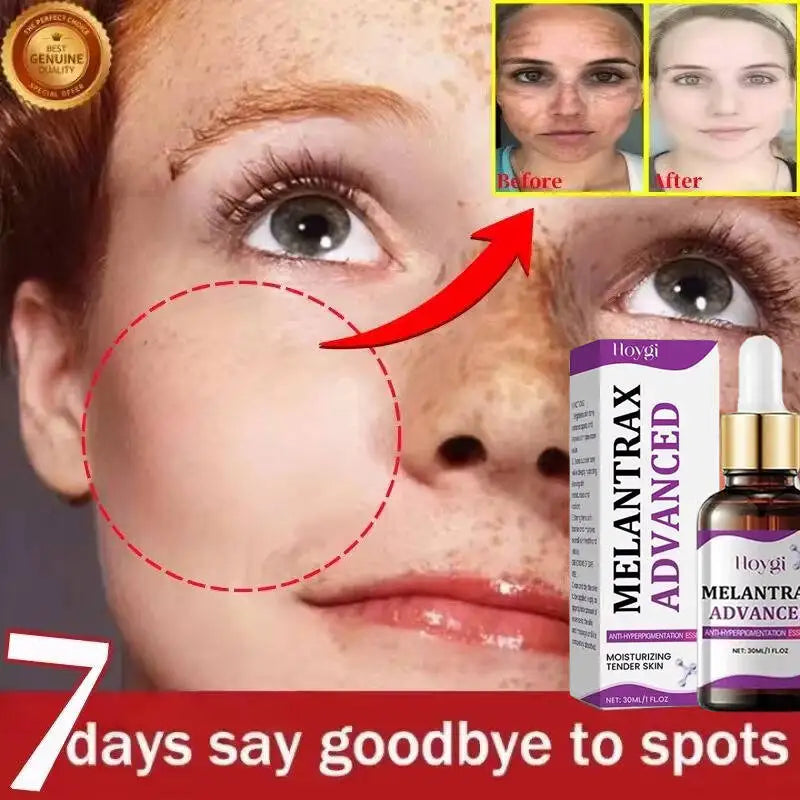 Hoygi Niacinamide Facial Serum Vitamin B3 Wrinkles Pigment Dark Spot Removal Correcting Glow Serum Face Whitening Moisturizer