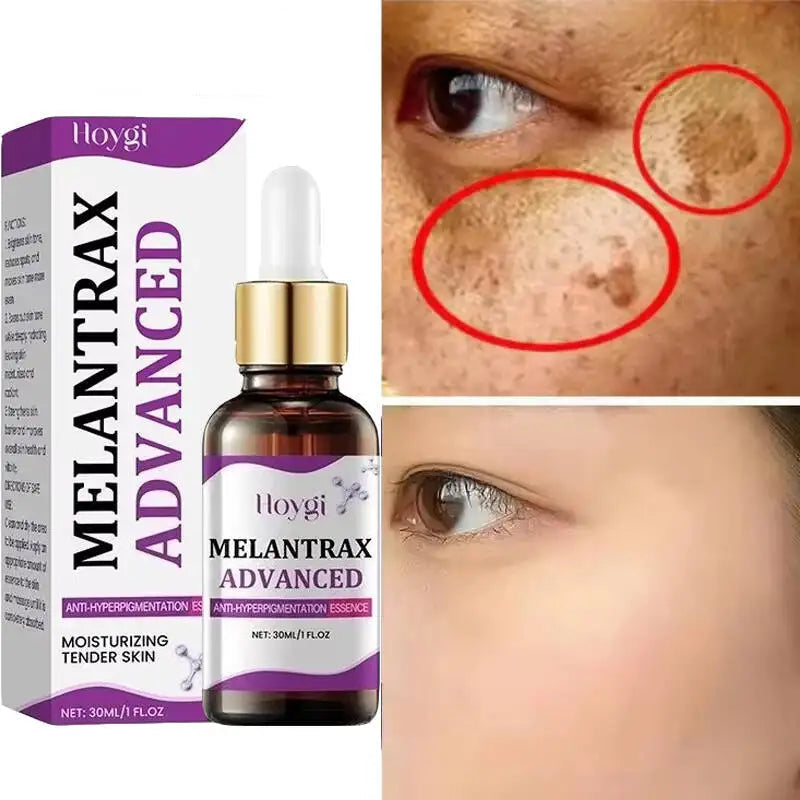 Hoygi Niacinamide Facial Serum Vitamin B3 Wrinkles Pigment Dark Spot Removal Correcting Glow Serum Face Whitening Moisturizer