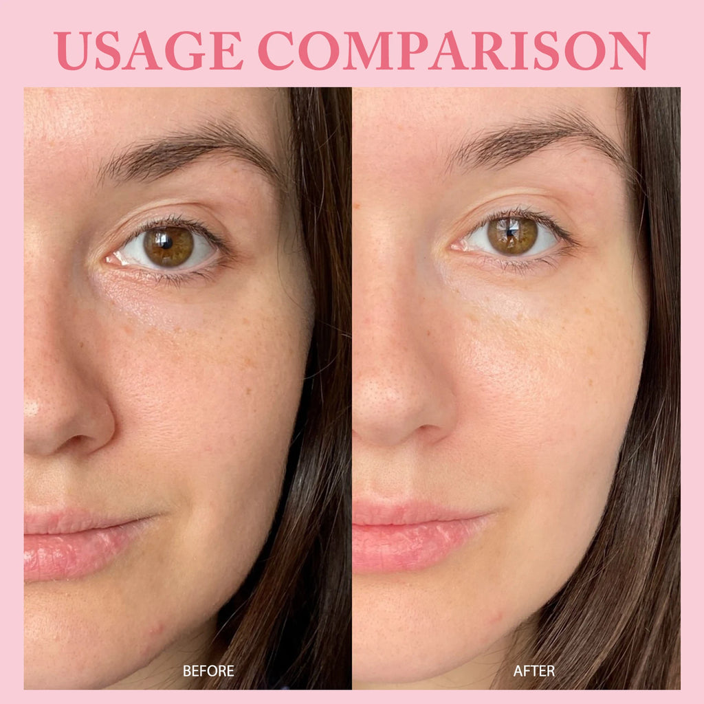 10Vials/Box PDRN Pink One Day Serum Firming Hydrating Ampoule Oil Control Pore Refining Smoothing Skin Rejuvenation Essence