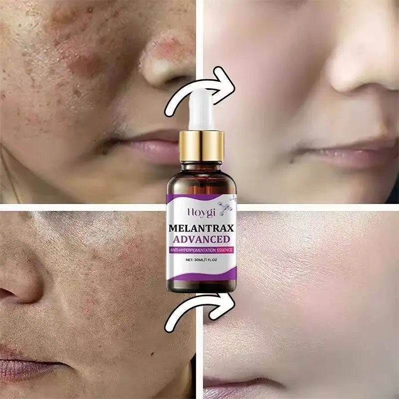 Hoygi Niacinamide Facial Serum Vitamin B3 Wrinkles Pigment Dark Spot Removal Correcting Glow Serum Face Whitening Moisturizer
